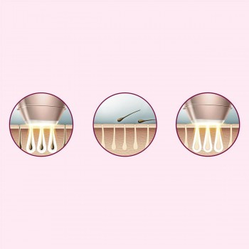 Philips Lumea Advanced Ipl Épilateur avec 2 embouts pour le corps, le visage & 1 tondeuse de précision pour les câbles